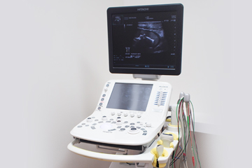 超音波画像診断装置（ARIETTA60）
